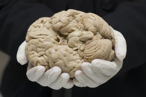 Hands wearing white gloves supporting a human brain. The brain shows the caudal view.